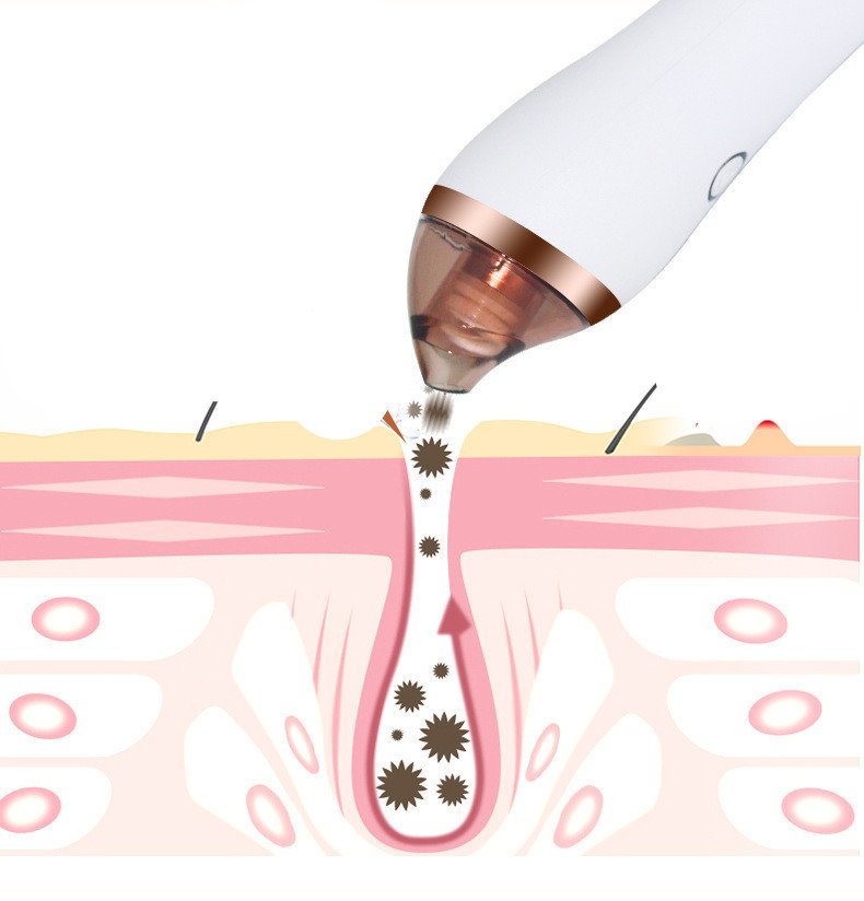 4-in-1 Vacuum Cupping & Facial Care Tool - Image 9