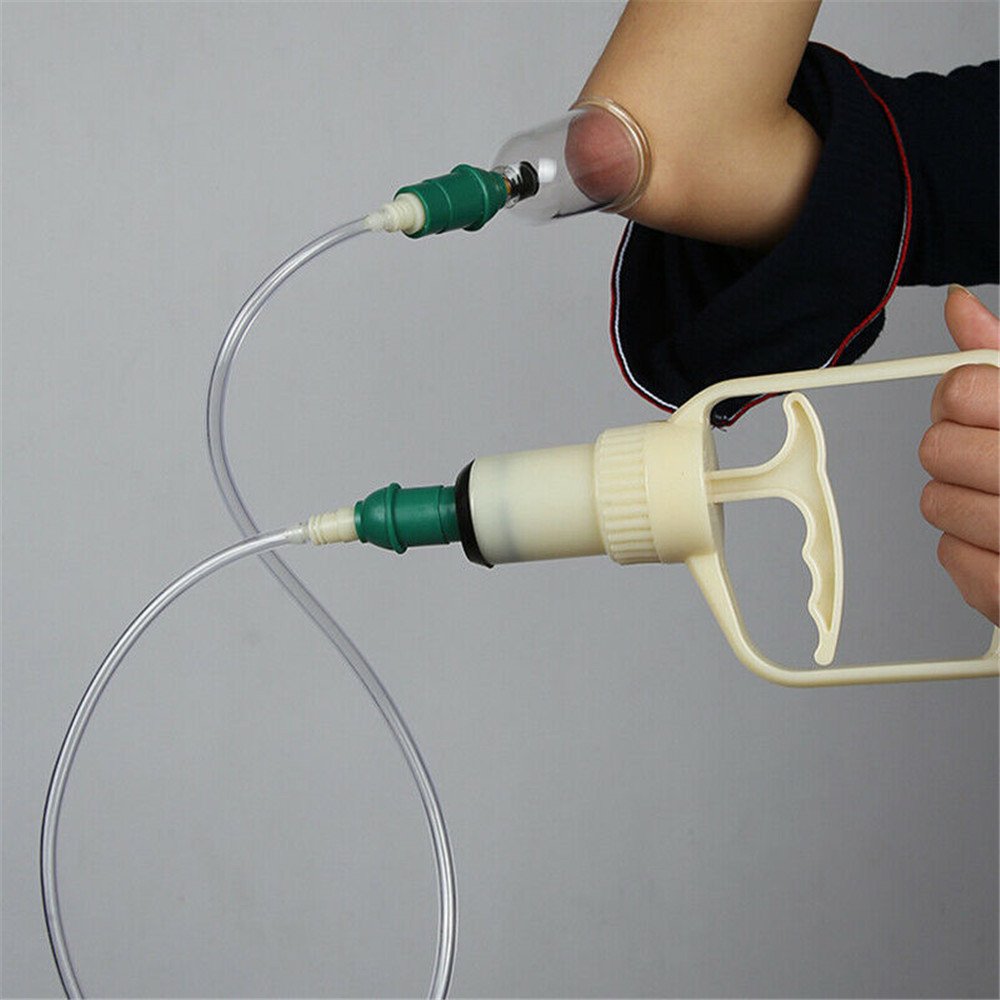 Kang Zhuci Cupping Device - Image 5