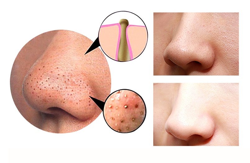 4-in-1 Vacuum Cupping & Facial Care Tool - Image 2