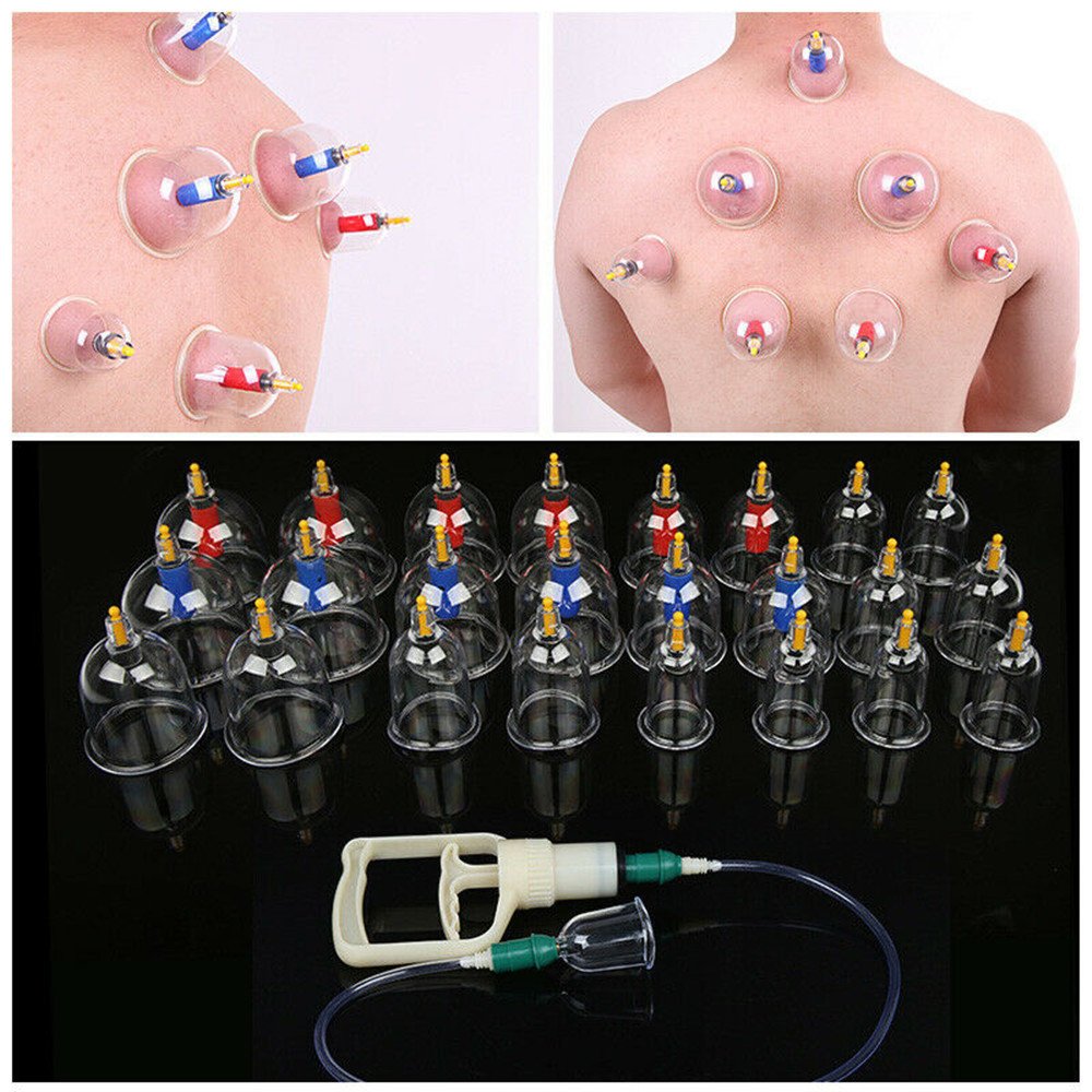 Kang Zhuci Cupping Device - Image 4