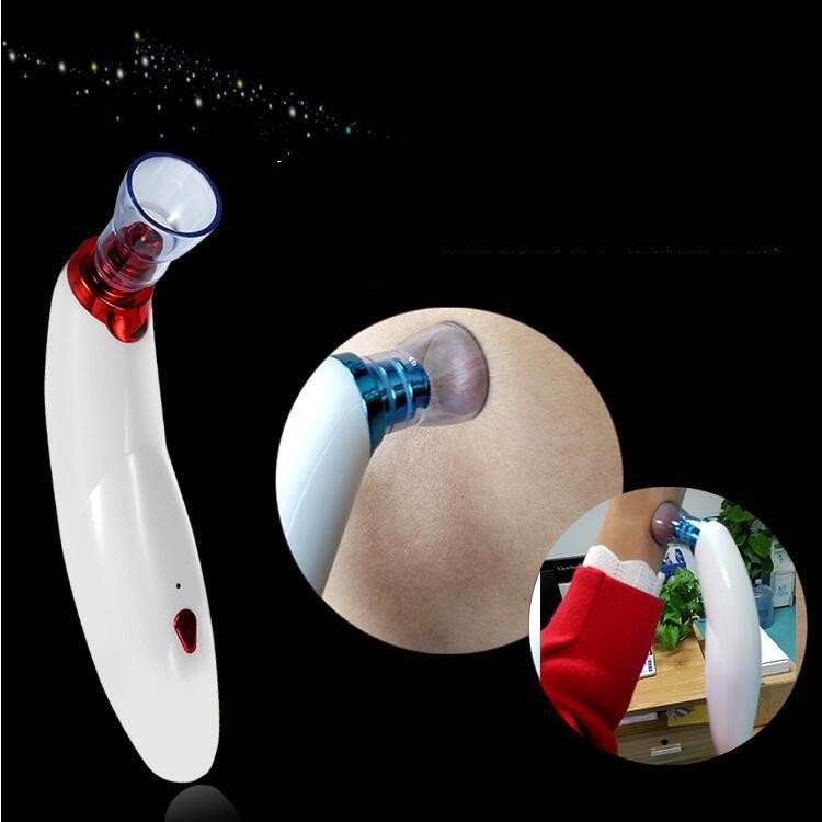 Electric Facial Pore Care & Cupping Cleaner - Image 3